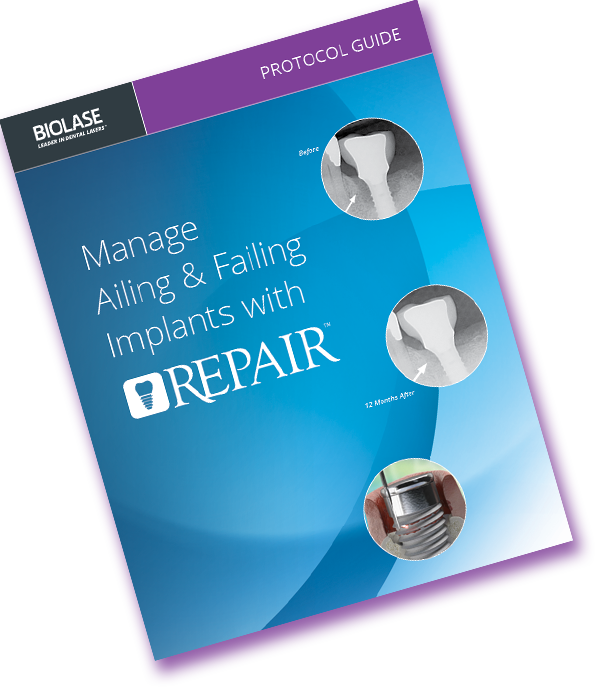 Waterlase REPAIR Implant Protocol Guide