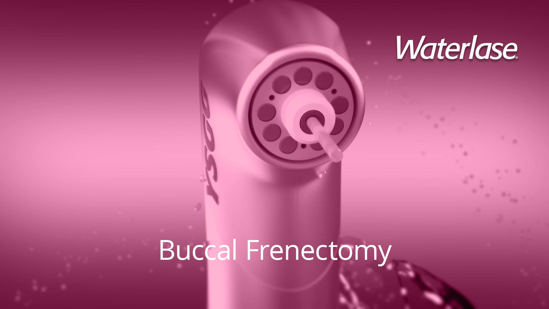 Waterlase Buccal Frenectomy