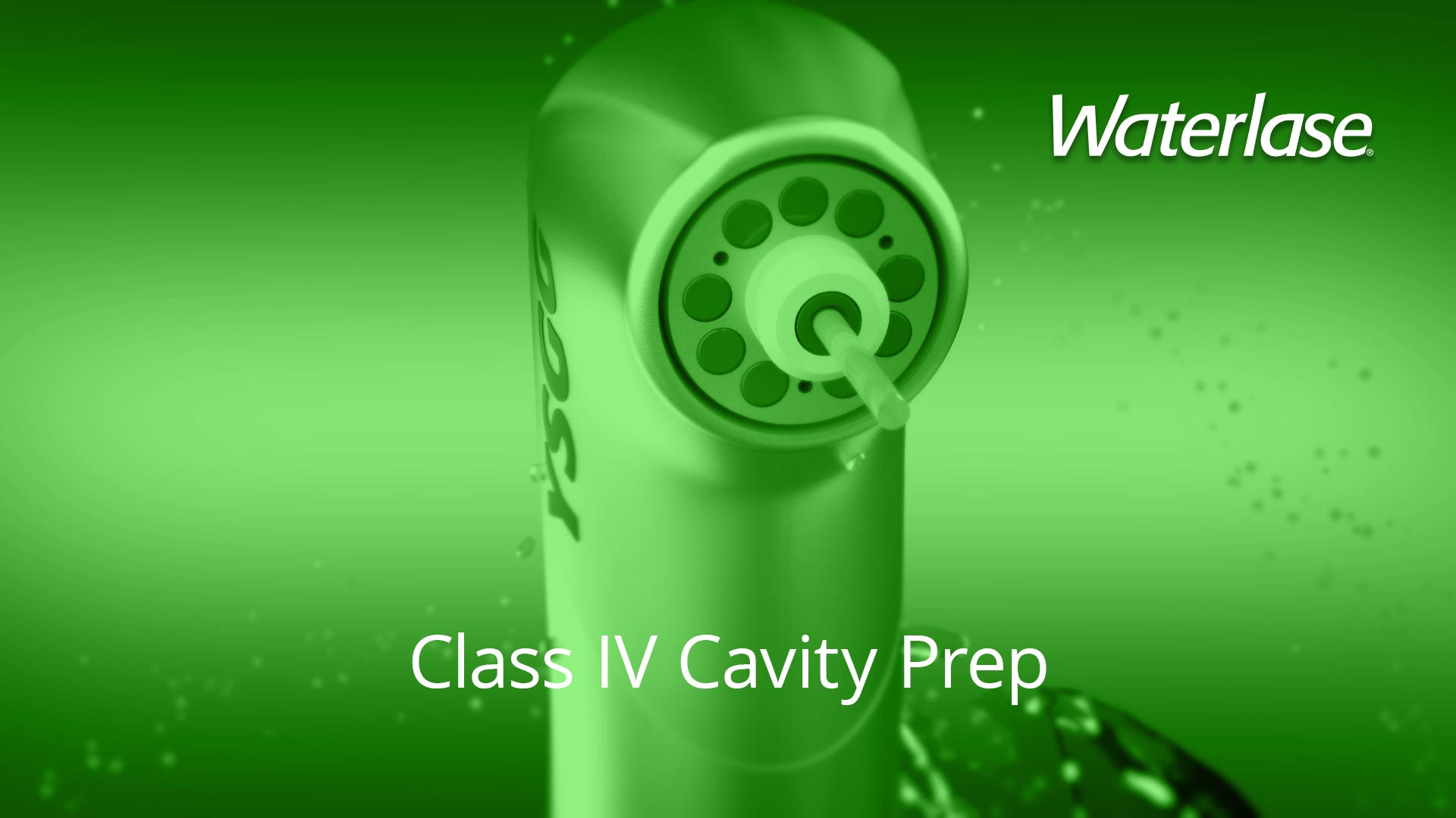 Waterlase Class IV Cavity Prep