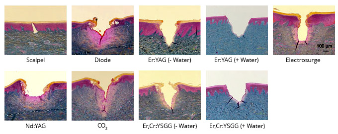 Histologic Comparison