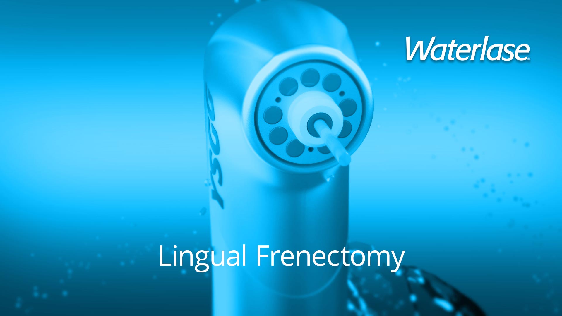 Waterlase Lingual Frenectomy