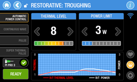 Epic Pro - Automatic Power Control