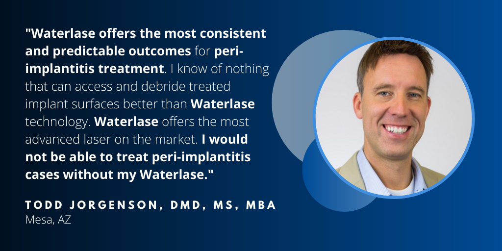 Waterlase Dentist - Dr. Todd Jorgenson