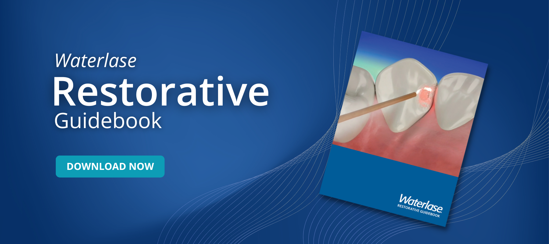 Waterlase Restorative Guidebook