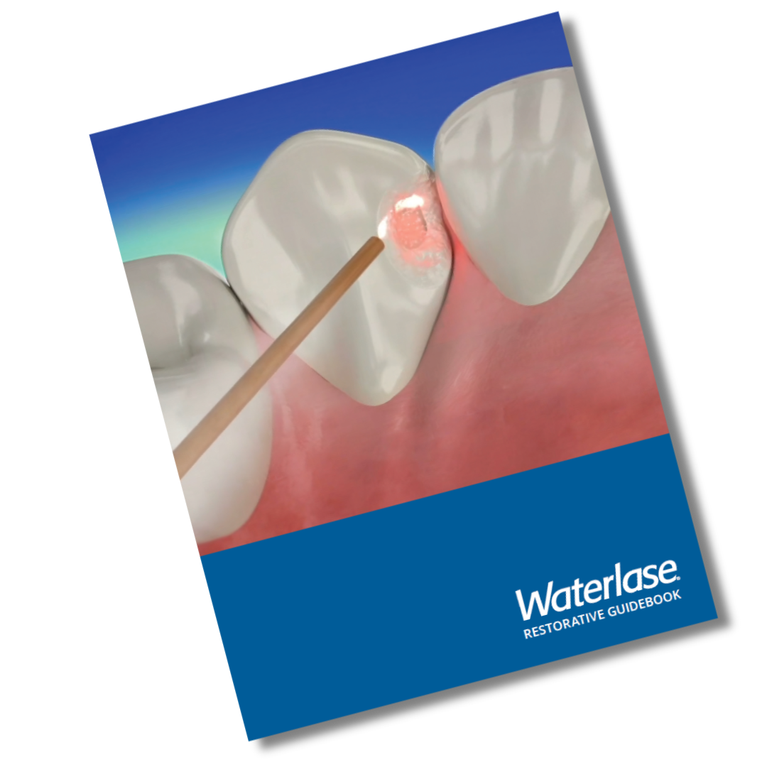 Waterlase Restorative Protocol Guide